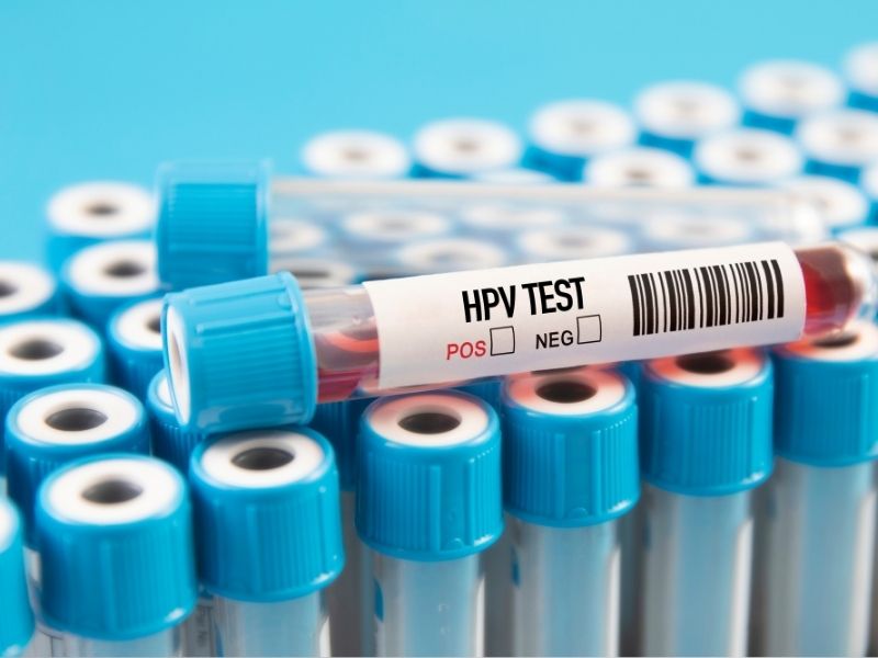 hpv-testi-nedir