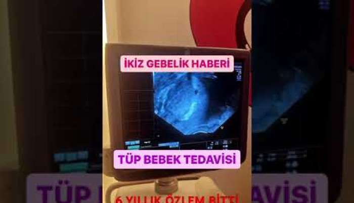 video,paylaşım,kameralı telefon,videofon,ücretsiz,yükleme